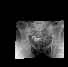 Miniatura de serie